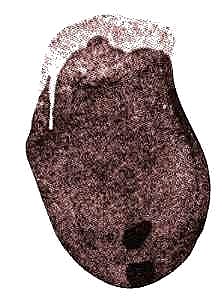 sperm partly covered by protoplasmic mass; cilia finely drawn (after Hirase, 1896)